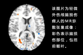 彌散是一個三維過程