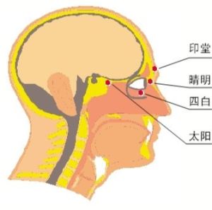 腦性耗鹽綜合徵