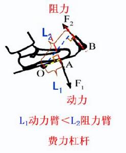 費力槓桿