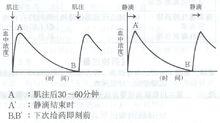 硫酸異帕米星注射液