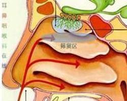 假單胞菌感染