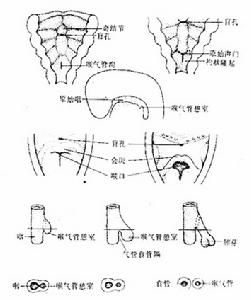 咽食管憩室