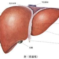 脾機能亢進