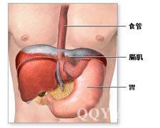 膈下膿腫