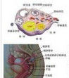 垂體膠樣囊腫