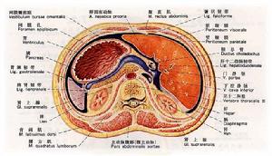 腹膜後疝