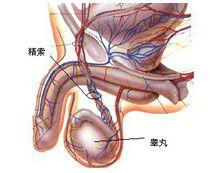 LOH男性遲發性性腺功能減退症