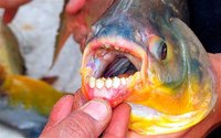 PACU