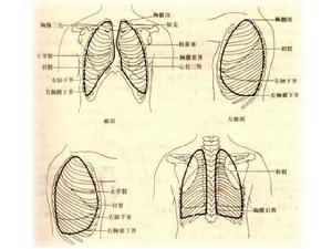 胸膜炎