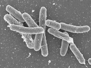 偽膜性結腸炎（pseudomenbraneouscolitis）是主要發生於結腸的急性黏膜壞死性炎症。