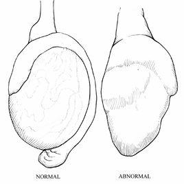 睪丸異常