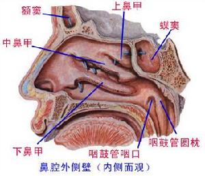 鼻出血