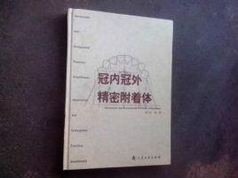 冠內冠外精密附著體