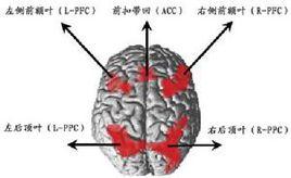 胼胝體變性