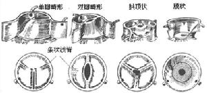 主動脈瓣膜部狹窄