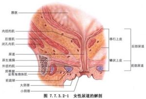 尿道肉阜