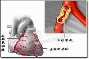 竇房傳導阻滯