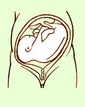 胎兒橫點陣圖