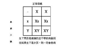 性聯遺傳型低磷酸鹽佝僂症