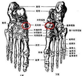 應力性骨折