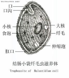 結腸小袋纖毛蟲病