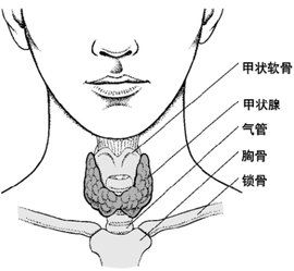 甲狀腺結節鈣化