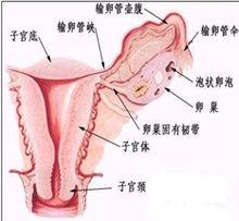 澳洲MIDEN微創保宮無痛人流術