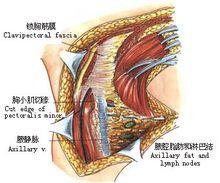 鎖胸筋膜