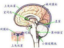 顯性脊柱裂