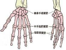 掌指關節脫位