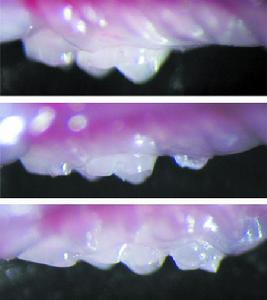 放置在小鼠上頜中的一個生物工程牙胚