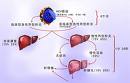 《C型肝炎的診斷和治療》