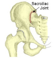 骶髂關節炎圖示