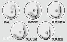 乳相