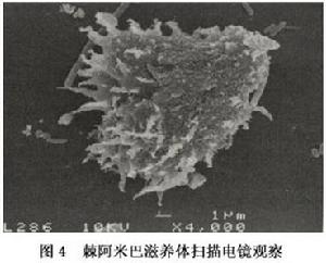 棘阿米巴性角膜炎