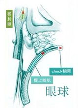 上瞼下垂矯正術加強睜眼力量的力學方向