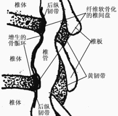 （圖）發病機制