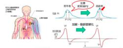 avi[中心動脈（心臟附近）硬化程度指標]