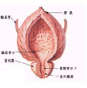 前列腺肉瘤