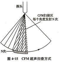 黑白超聲診斷系統