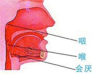 咽炎