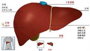 肝硬化性腎損害