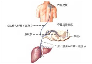 牽涉痛發生機制