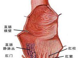 腸管變形