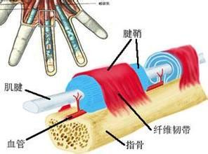 肌腱炎