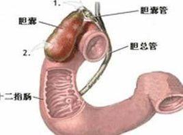 膽囊體積縮小