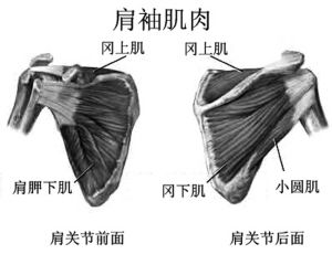 肩袖損傷