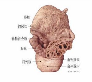 前列腺增生危害