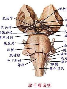 腦幹損傷