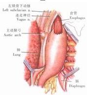示意圖7:固定胃壁與後胸壁